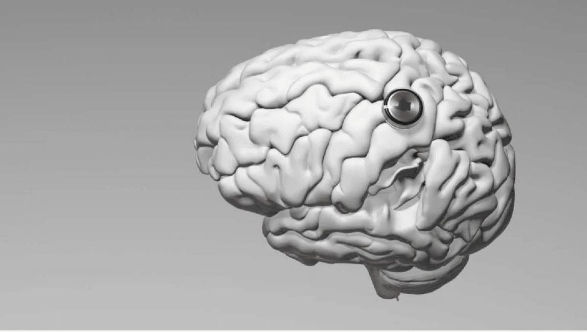 Китай приєднується до США в гонці за мозковими імплантатами / фото Neuralink