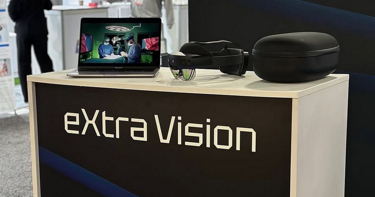 Революційні AR-окуляри українського стартапу eXtra Vision: як хірурги змінюють медицину зі 200+ успішними операціями